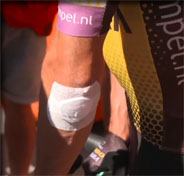 calpe ROGLIC blessure au coude